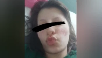 Türbanlı Snapte